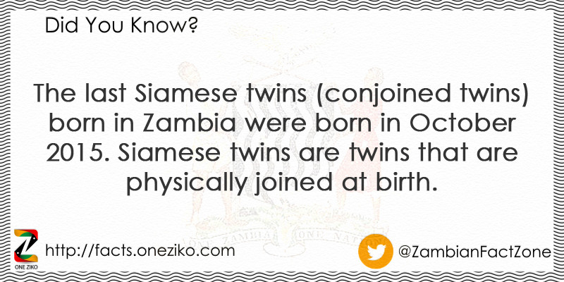 The last Siamese twins (conjoined twins) born in Z...